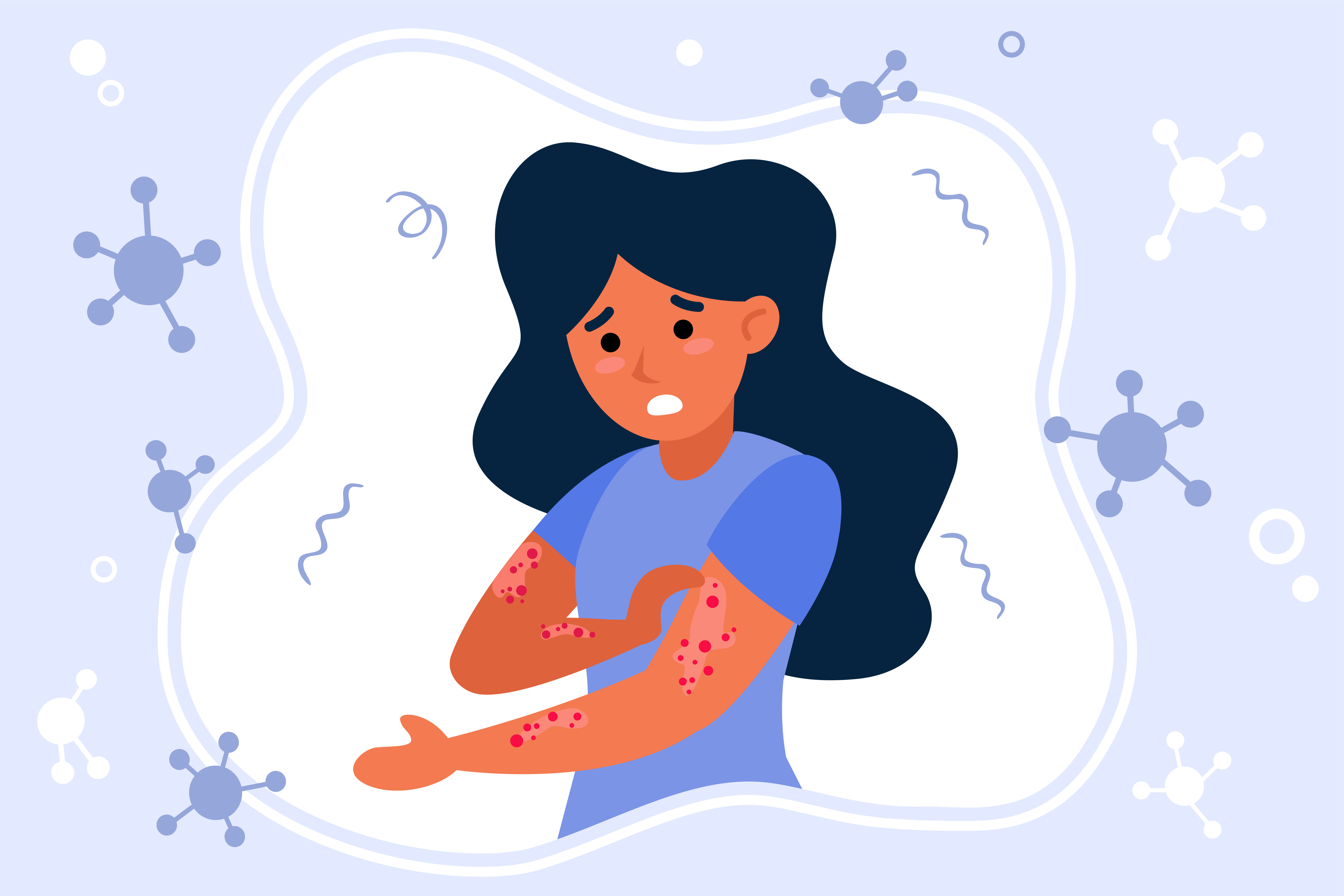 Tips to manage eczema in winter  post image