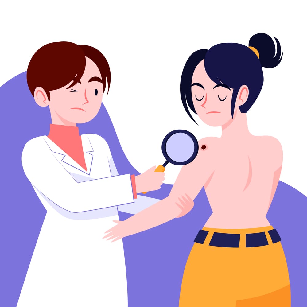 Why you need to get a skin check post image